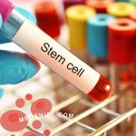 Life-Changing Type 1 Diabetes Breakthroughs: How Stem Cells, CRISPR, and Engineered Islets Could End Insulin Dependence