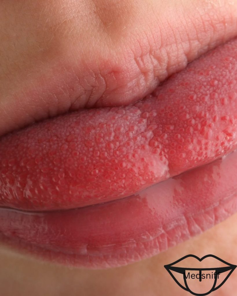 Top 10 Disgusting Flavours That Reveal Your Dirty Health Secrets 